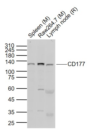 Western blot - Anti-CD177 antibody (AB203025), expandable thumbnail