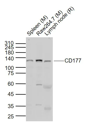 Western blot - Anti-CD177 antibody (AB203025)