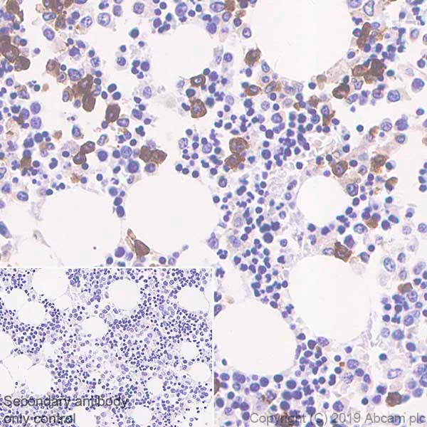 Immunohistochemistry (Formalin/PFA-fixed paraffin-embedded sections) - Anti-CD177 antibody [EPR22813-205] (AB255296)
