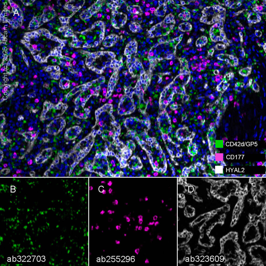 Multiplex immunohistochemistry - Anti-CD177 antibody [EPR22813-205] (AB255296)