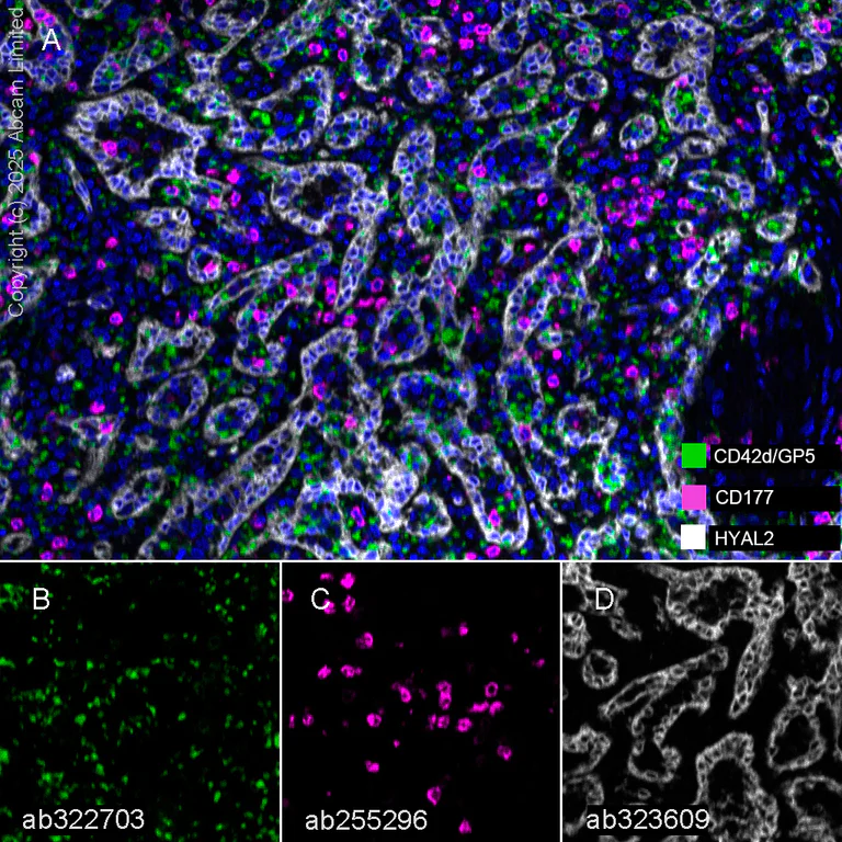 Multiplex immunohistochemistry - Anti-CD177 antibody [EPR22813-205] (AB255296)