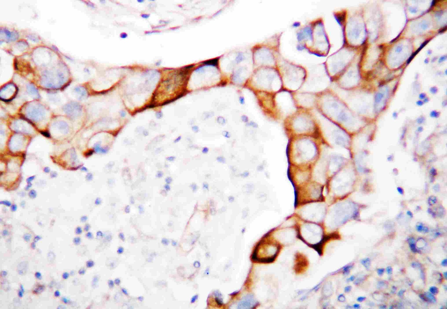 Immunohistochemistry (Formalin/PFA-fixed paraffin-embedded sections) - Anti-CD18 antibody (AB131044), expandable thumbnail