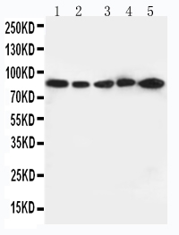 Western blot - Anti-CD18 antibody (AB131044), expandable thumbnail