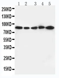 Western blot - Anti-CD18 antibody (AB131044)