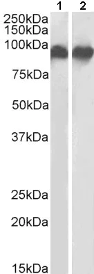 Western blot - Anti-CD18 antibody (AB195994)