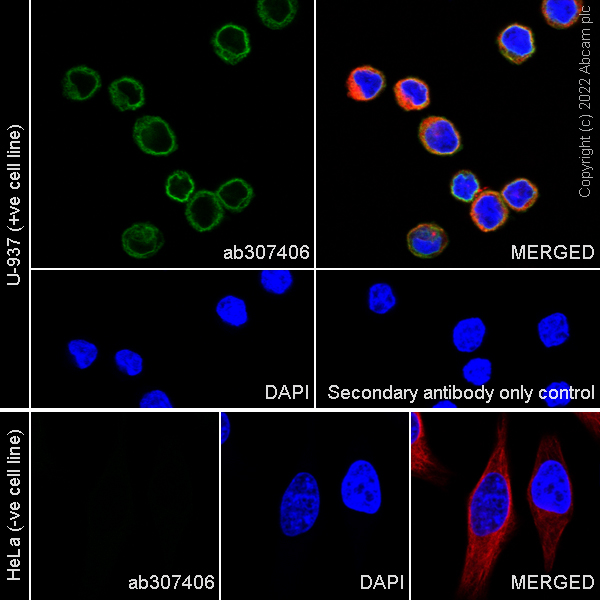 Immunocytochemistry/ Immunofluorescence - Anti-CD18 antibody [EPR26929-26] (ab307406), expandable thumbnail