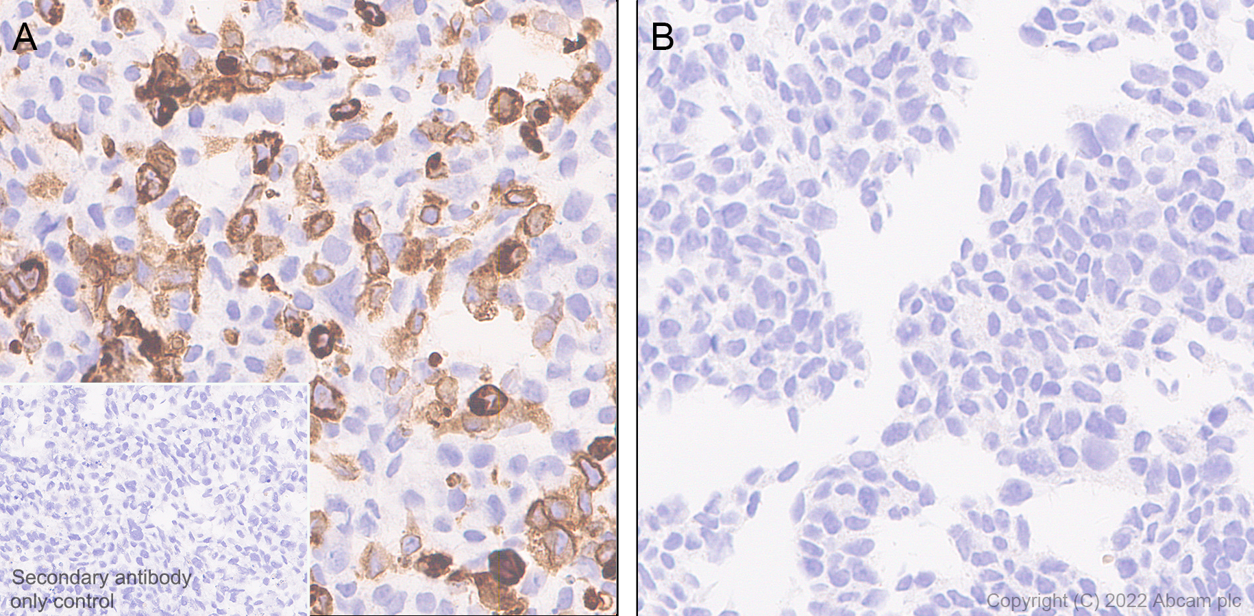 Immunohistochemistry (Formalin/PFA-fixed paraffin-embedded sections) - Anti-CD18 antibody [EPR26929-26] (ab307406), expandable thumbnail