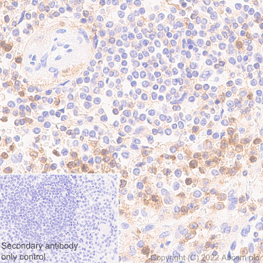 Immunohistochemistry (Formalin/PFA-fixed paraffin-embedded sections) - Anti-CD18 antibody [EPR26929-26] (AB307406), expandable thumbnail