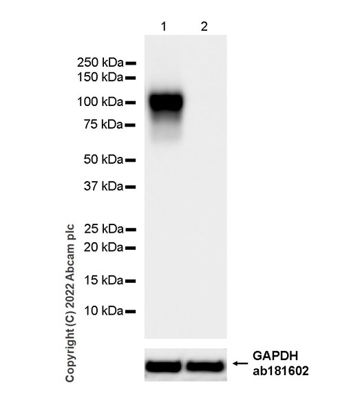 Western blot - Anti-CD18 antibody [EPR26929-26] (AB307406), expandable thumbnail