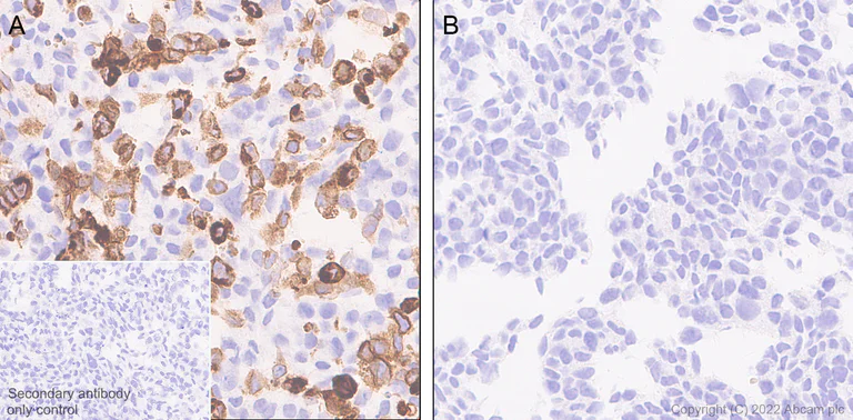 Immunohistochemistry (Formalin/PFA-fixed paraffin-embedded sections) - Anti-CD18 antibody [EPR26929-26] - BSA and Azide free (AB307407)