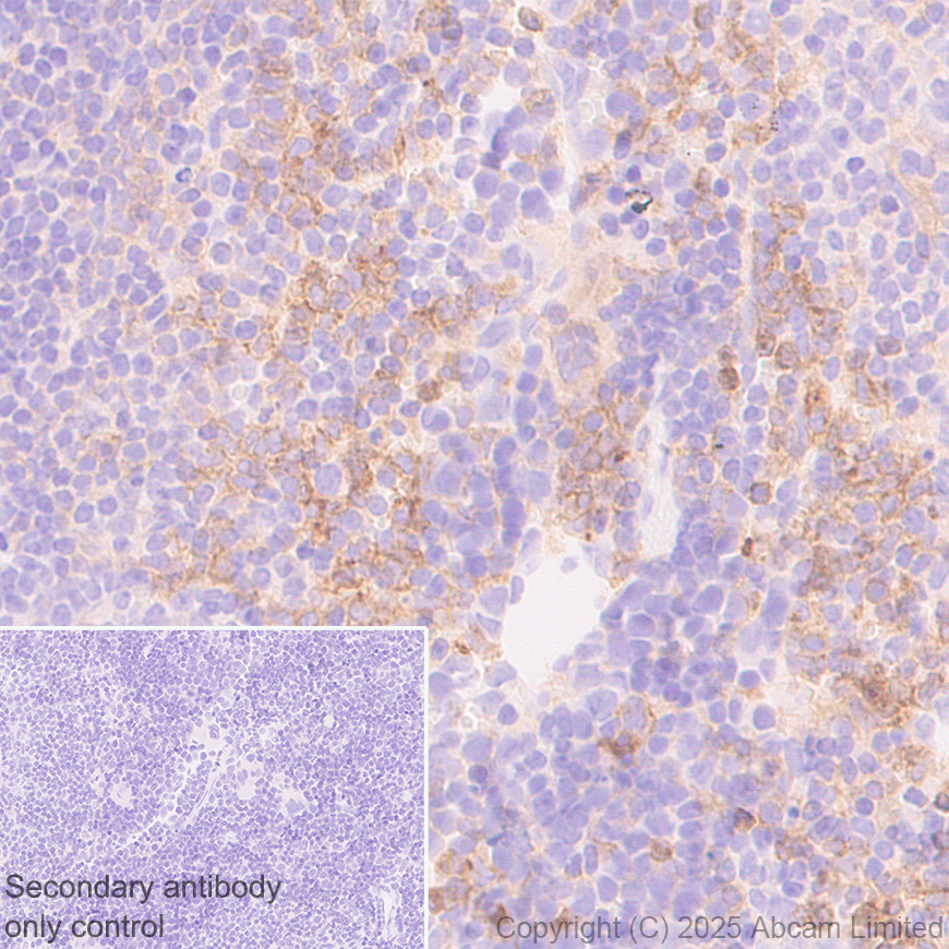 Immunohistochemistry (Formalin/PFA-fixed paraffin-embedded sections) - Anti-CD18 antibody [EPR29884-566] (ab324101), expandable thumbnail