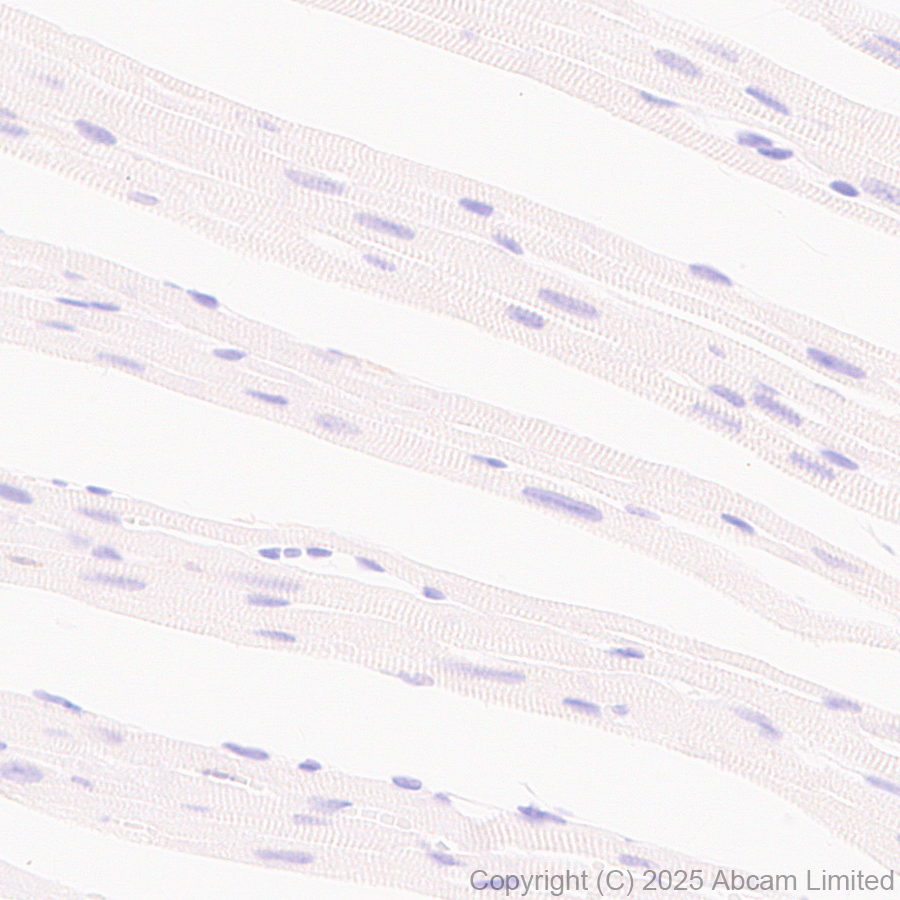Immunohistochemistry (Formalin/PFA-fixed paraffin-embedded sections) - Anti-CD18 antibody [EPR29884-566] (AB324101), expandable thumbnail