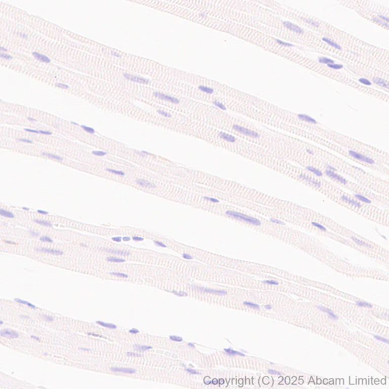 Immunohistochemistry (Formalin/PFA-fixed paraffin-embedded sections) - Anti-CD18 antibody [EPR29884-566] (AB324101)