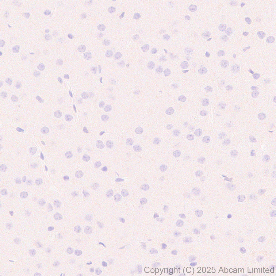 Immunohistochemistry (Formalin/PFA-fixed paraffin-embedded sections) - Anti-CD18 antibody [EPR29884-566] (ab324101), expandable thumbnail
