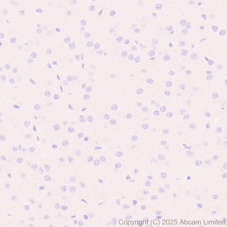 Immunohistochemistry (Formalin/PFA-fixed paraffin-embedded sections) - Anti-CD18 antibody [EPR29884-566] (AB324101)
