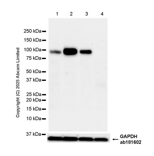 Western blot - Anti-CD18 antibody [EPR29884-566] (AB324101), expandable thumbnail