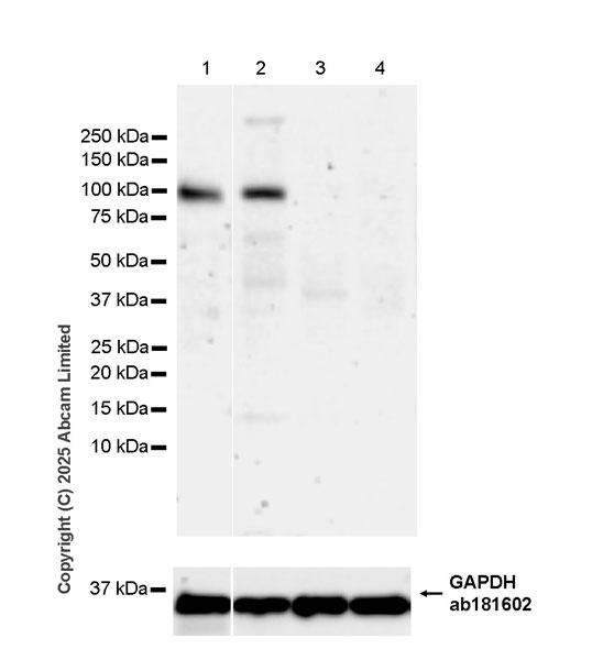 Western blot - Anti-CD18 antibody [EPR29884-566] (AB324101), expandable thumbnail