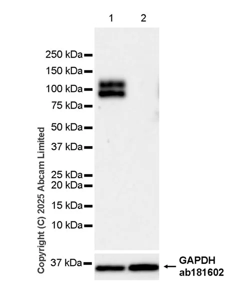 Western blot - Anti-CD18 antibody [RM1357] (AB325521)