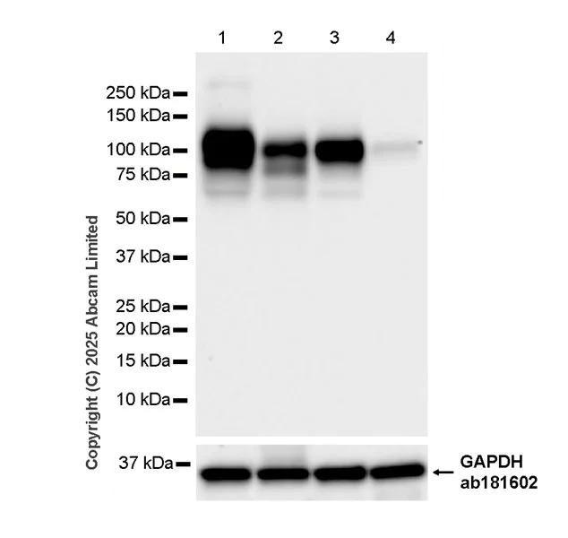 Western blot - Anti-CD18 antibody [RM1357] (AB325521)