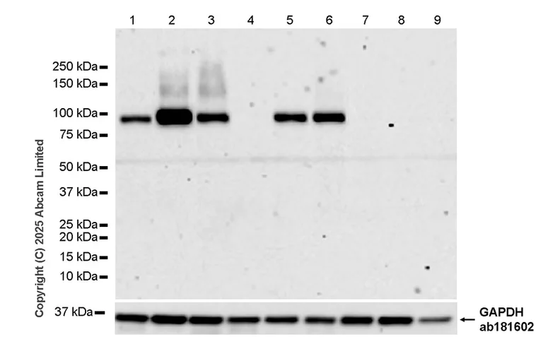 Western blot - Anti-CD18 antibody [RM1357] (AB325521)