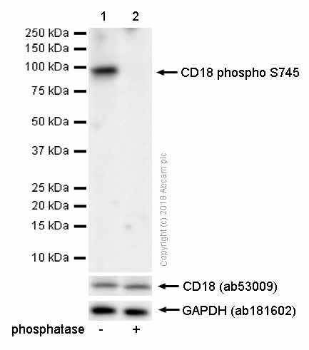 Western blot - Anti-CD18 (phospho S745) antibody [EP1288Y] (AB52920)