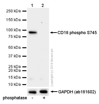 Western blot - Anti-CD18 (phospho S745) antibody [EP1288Y] (AB52920)