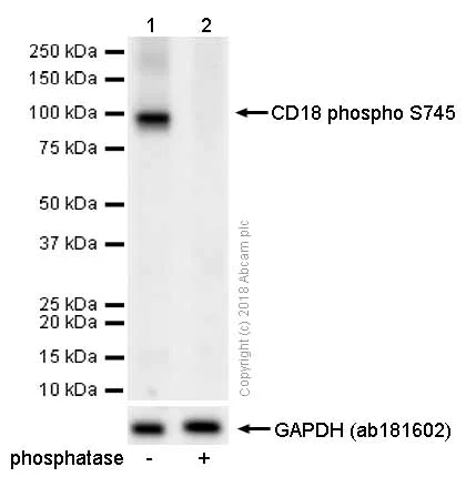 Western blot - Anti-CD18 (phospho S745) antibody [EP1288Y] (AB52920)