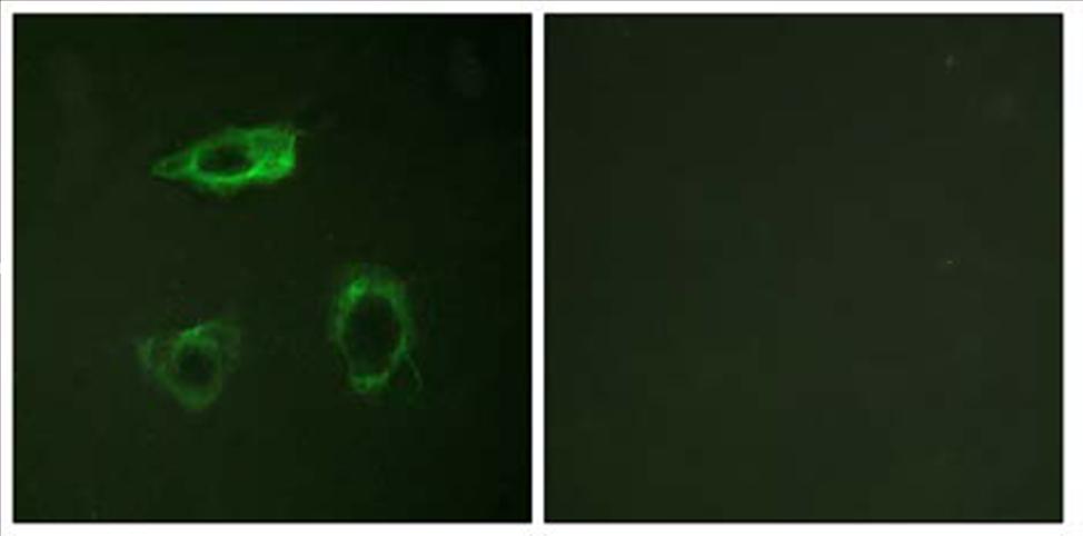 Immunocytochemistry/ Immunofluorescence - Anti-CD18 (phospho T758) antibody (AB63388)