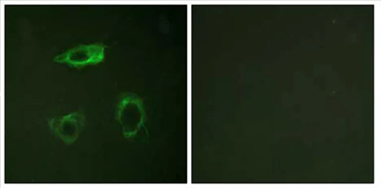 Immunocytochemistry/ Immunofluorescence - Anti-CD18 (phospho T758) antibody (AB63388)