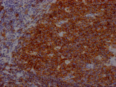 Immunohistochemistry (Formalin/PFA-fixed paraffin-embedded sections) - Anti-CD19 antibody [4C7] (AB288365)