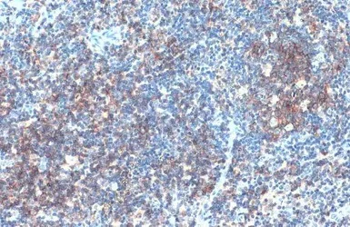 Immunohistochemistry (Formalin/PFA-fixed paraffin-embedded sections) - Anti-CD19 antibody (AB227019)