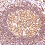 Immunohistochemistry (Formalin/PFA-fixed paraffin-embedded sections) - Anti-CD19 antibody (AB99965)