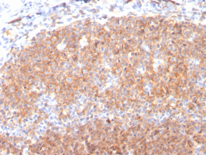 Immunohistochemistry (Formalin/PFA-fixed paraffin-embedded sections) - Anti-CD19 antibody [CD19/3117] (AB270715), expandable thumbnail