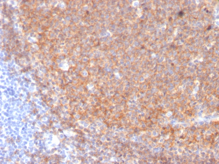 Immunohistochemistry (Formalin/PFA-fixed paraffin-embedded sections) - Anti-CD19 antibody [CD19/3117] (AB270715), expandable thumbnail