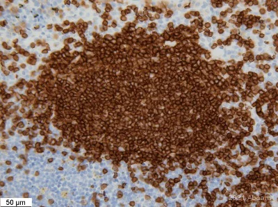 Immunohistochemistry (Formalin/PFA-fixed paraffin-embedded sections) - Anti-CD19 antibody [EPR23174-145] (AB245235)