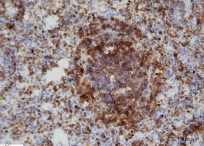 Immunohistochemistry (Frozen sections) - Anti-CD19 antibody [EPR23174-145] (AB245235)