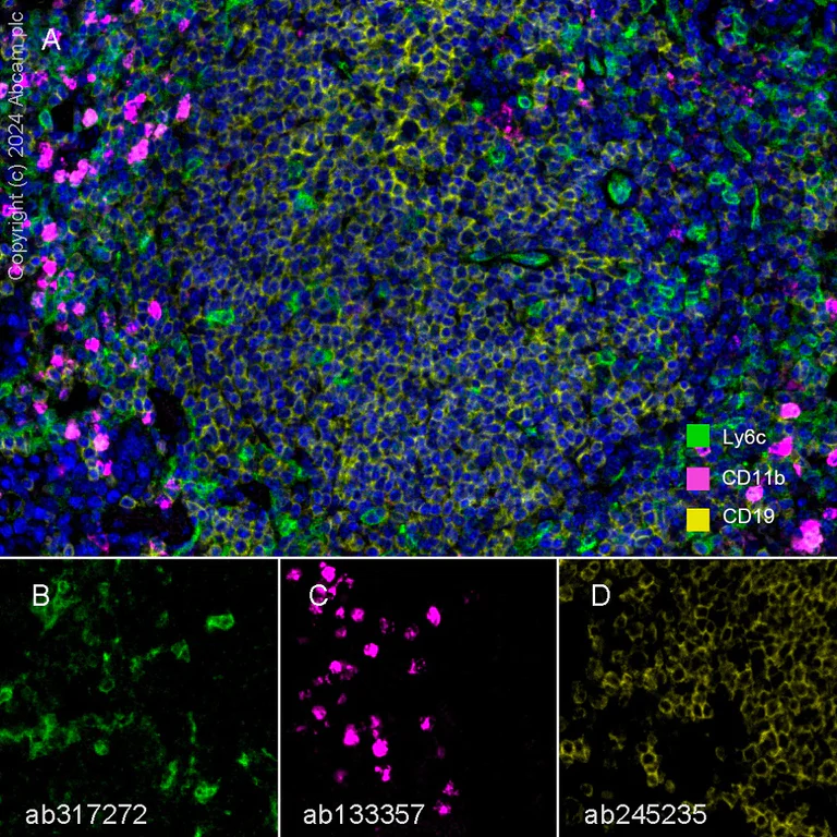 Multiplex immunohistochemistry - Anti-CD19 antibody [EPR23174-145] (AB245235)