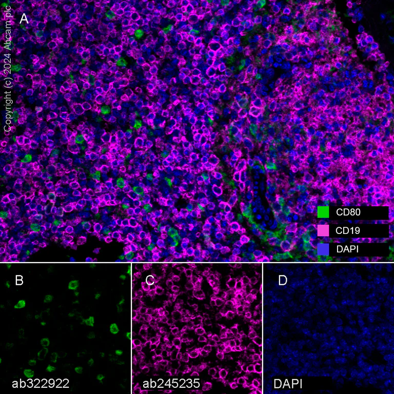 Multiplex immunohistochemistry - Anti-CD19 antibody [EPR23174-145] (AB245235)