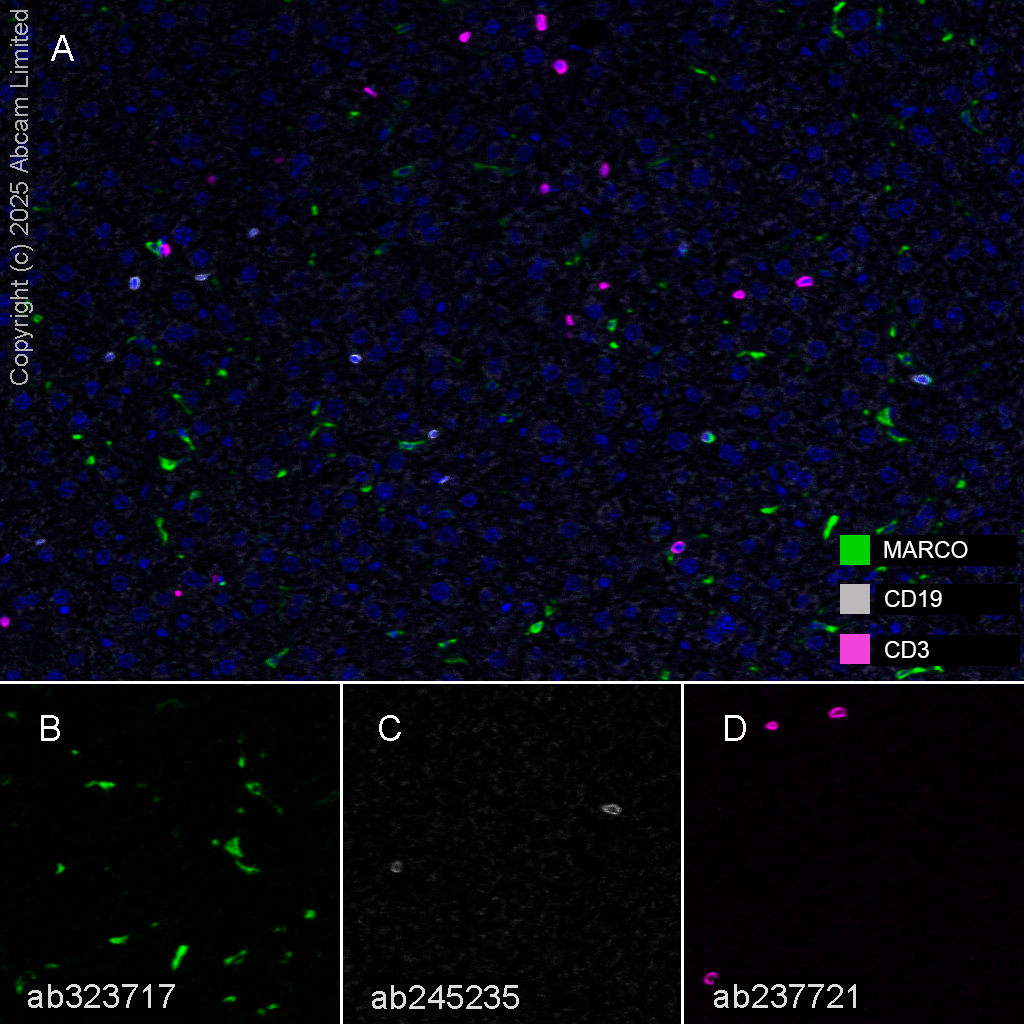 Multiplex immunohistochemistry - Anti-CD19 antibody [EPR23174-145] (ab245235), expandable thumbnail