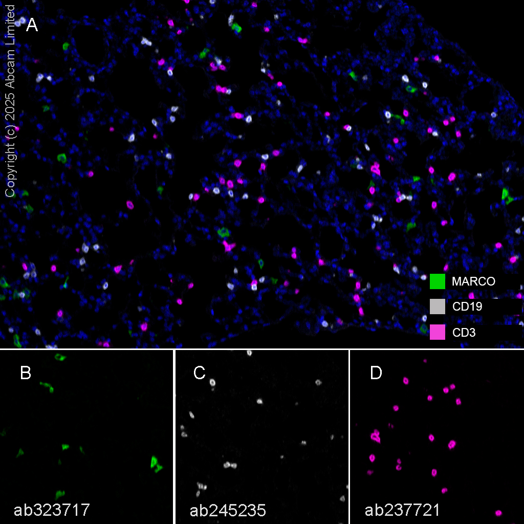 Multiplex immunohistochemistry - Anti-CD19 antibody [EPR23174-145] (ab245235), expandable thumbnail