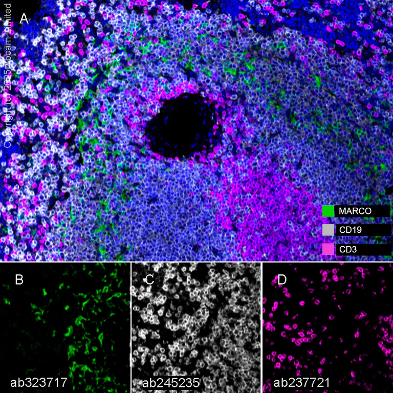 Multiplex immunohistochemistry - Anti-CD19 antibody [EPR23174-145] (AB245235)