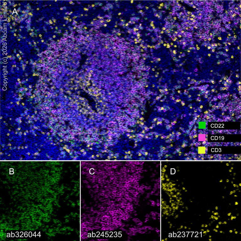 Multiplex immunohistochemistry - Anti-CD19 antibody [EPR23174-145] (AB245235)