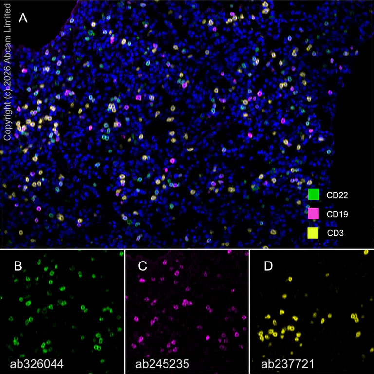 Multiplex immunohistochemistry - Anti-CD19 antibody [EPR23174-145] (AB245235)