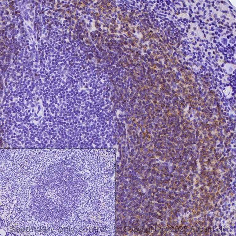 Immunohistochemistry (Formalin/PFA-fixed paraffin-embedded sections) - Anti-CD19 antibody [EPR23174-145] - BSA and Azide free (AB267394)