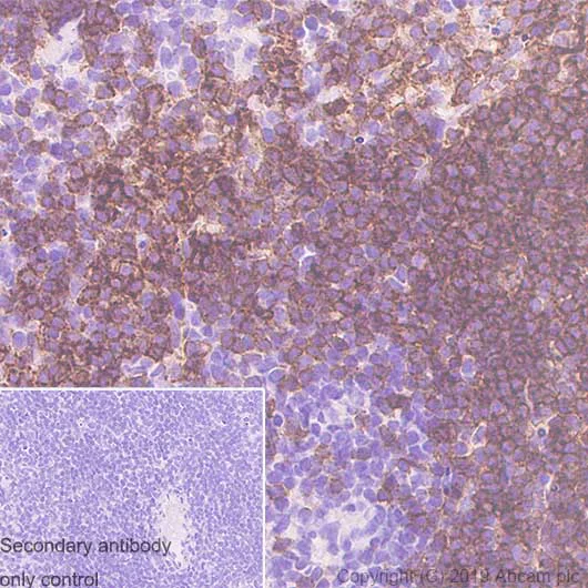 Immunohistochemistry (Formalin/PFA-fixed paraffin-embedded sections) - Anti-CD19 antibody [EPR23174-145] - BSA and Azide free (AB267394)