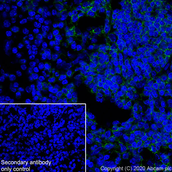Immunohistochemistry (Frozen sections) - Anti-CD19 antibody [EPR23174-145] - BSA and Azide free (AB267394)