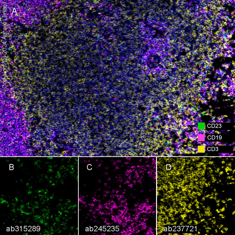 Multiplex immunohistochemistry - Anti-CD19 antibody [EPR23174-145] - BSA and Azide free (AB267394)