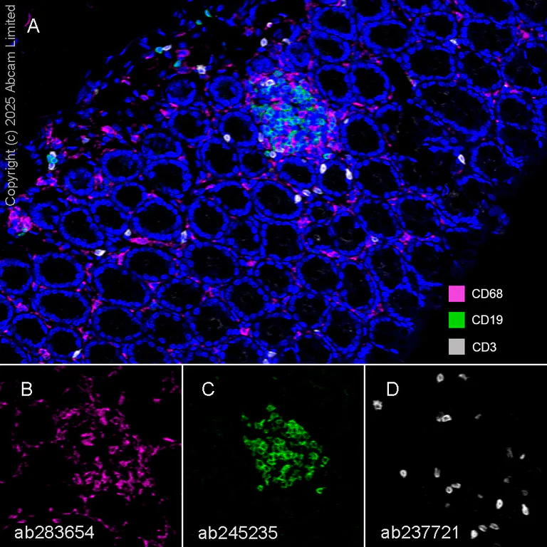 Multiplex immunohistochemistry - Anti-CD19 antibody [EPR23174-145] - BSA and Azide free (AB267394)