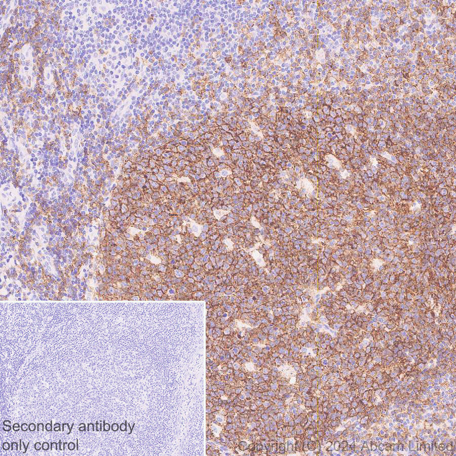 Immunohistochemistry (Formalin/PFA-fixed paraffin-embedded sections) - Anti-CD19 antibody [EPR28949-559] (ab320735), expandable thumbnail