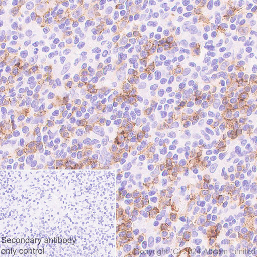 Immunohistochemistry (Formalin/PFA-fixed paraffin-embedded sections) - Anti-CD19 antibody [EPR28949-559] (ab320735), expandable thumbnail